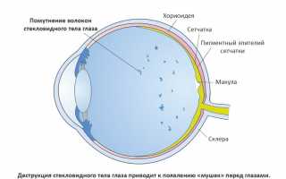 Что такое ангиопатия сосудов сетчатки