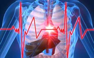 Признаки грудной жабы (стенокардии), причины появления и лечение