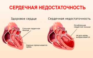 Причины отдышки и сердцебиение  у молодых и пожилых людей и методы лечения