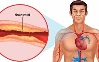 Нормы холестерина у мужчин по возрасту