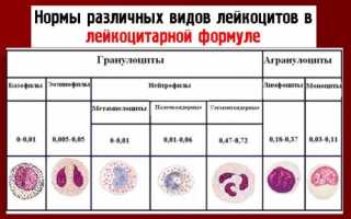 Значение палочкоядерных нейтрофилов в крови: их норма и причины отклонения