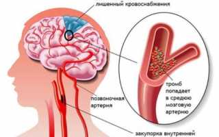 Можно ли выполнять массаж при атеросклерозе