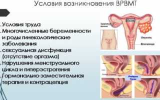 Варикоз малого таза: причины и последствия