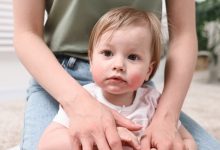 Photo of Как избежать аллергических реакций