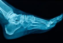 Photo of Секреты здоровья костей и суставов