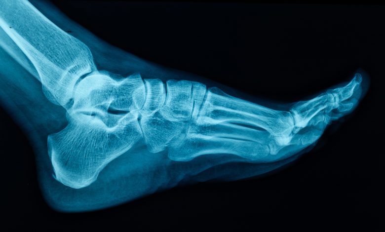 Photo of Секреты здоровья костей и суставов